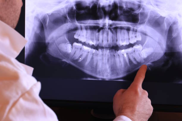 Best Emergency Dentist for Knocked-Out Tooth in Blaine, TN