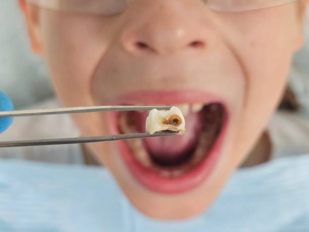 Best Holiday Emergency Dentist in Blaine, TN